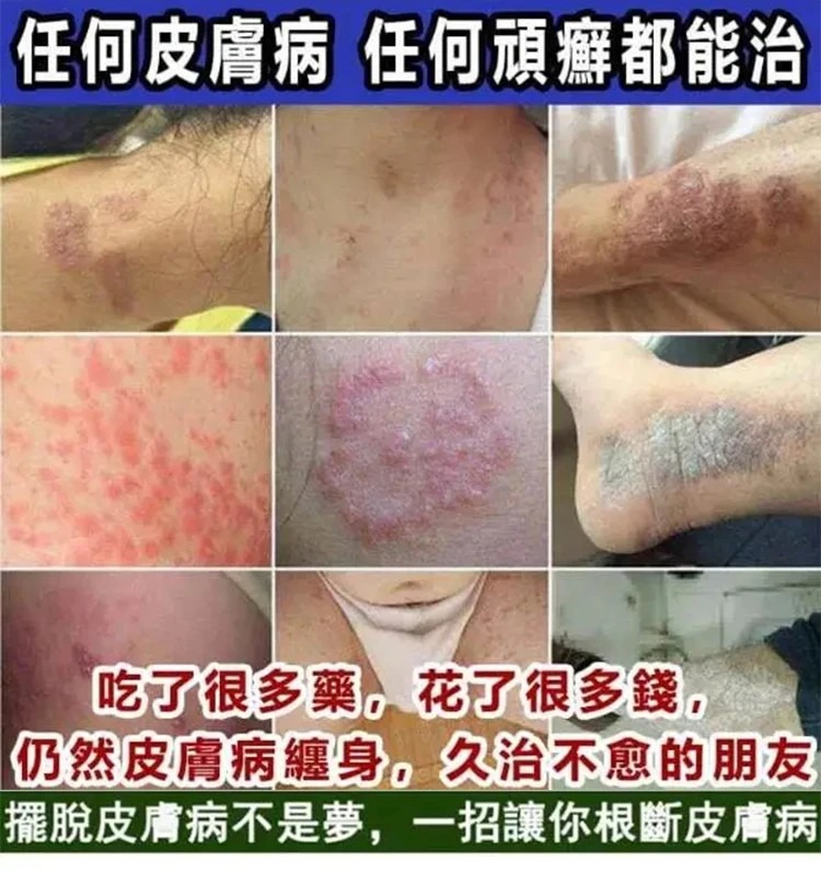 1760080101213931.jpg imgi_21_1743066346530802.jpg